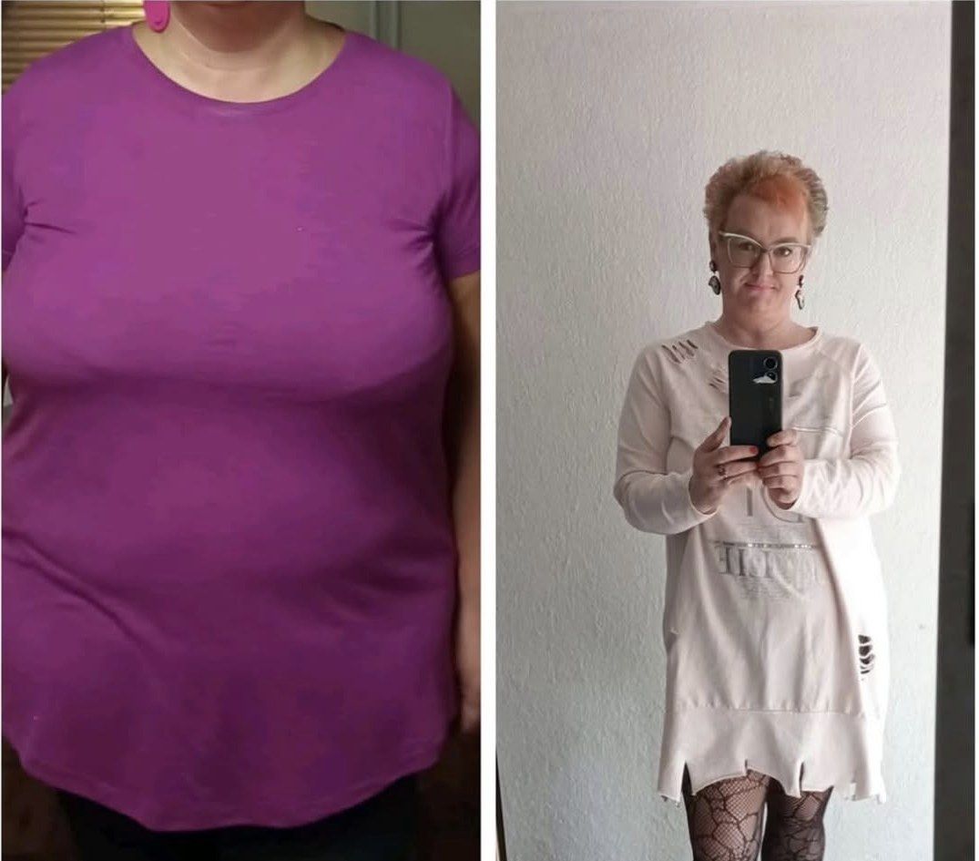 Premena klienta: −24 kg za pol roka (Klientka) – pred a po